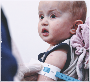 Malnutrition in Syria: The Role of the Independent Doctors Association Malnutrition in Syria: The Role of the Independent Doctors Association